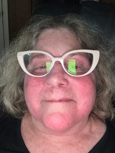 Customer photo review of Neptune Grass Fed Tallow & Honey Balm