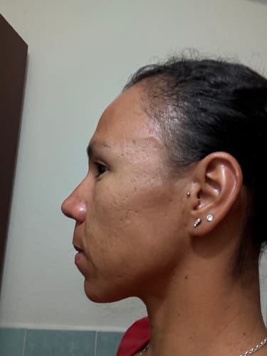 Customer photo review of Formula Personalizada (Rx)