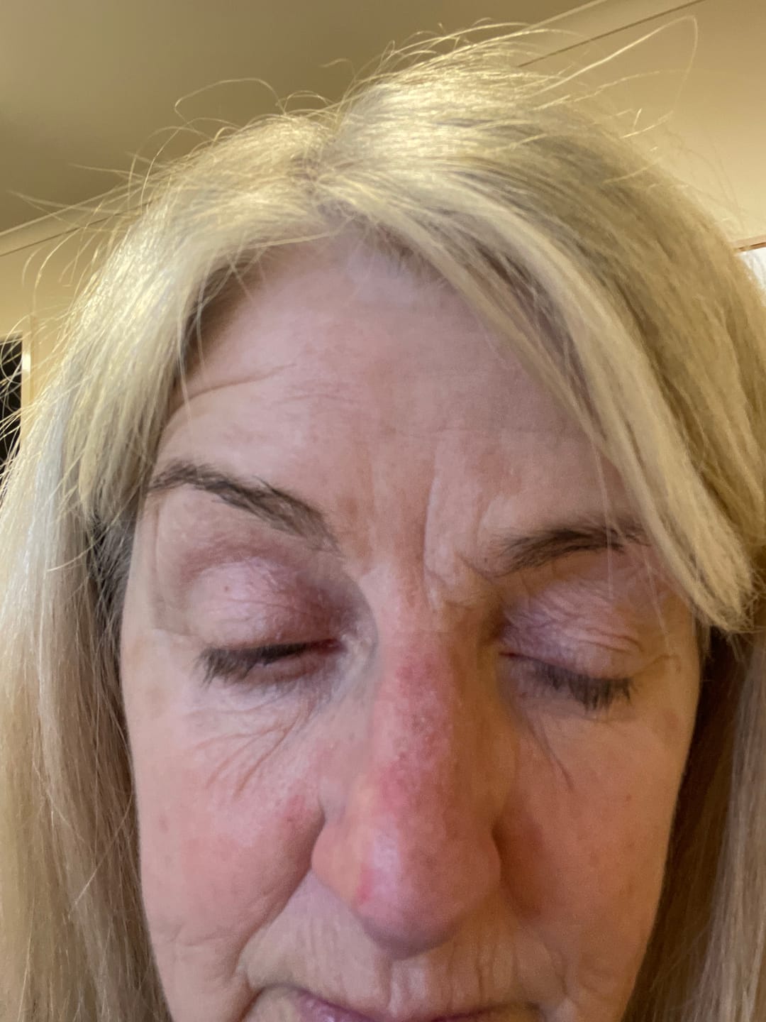 Customer photo review of Purely Lashes Lash Growth Serum