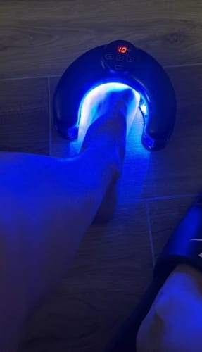 Customer photo review of NUVEX Multi-Nail LED Anti-Fungus Device