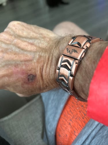 Customer photo review of Aegis Vortex Magnetic Copper Bracelet: Helps Pair Veterans With A Service Dog Or Shelter Dog