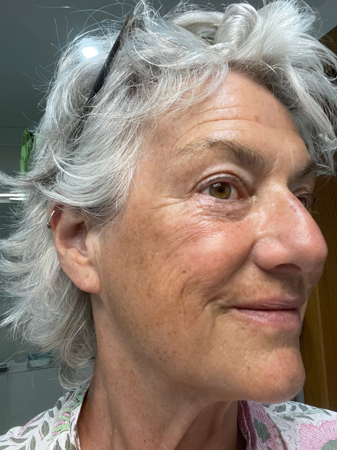 Customer photo review of The Complete System for Mature Women’s Skin