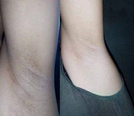 Customer photo review of Dark Spot Brightening Cream