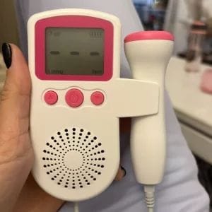 Customer photo review of Sonoline B Baby Doppler