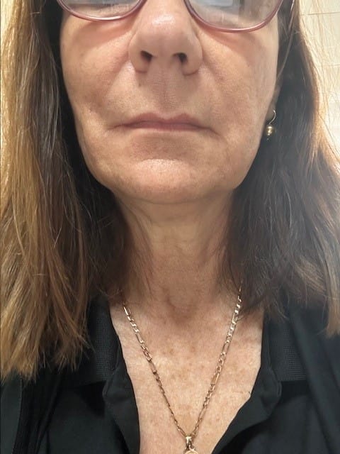 Customer photo review of dr.NC CONCENTRATED ILLUMINATOR 10% Vit B3, 10% Vit C - 30ml