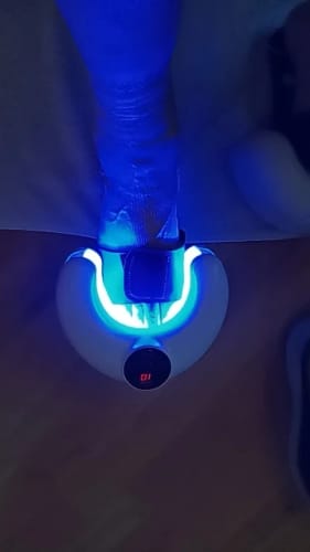 Customer photo review of NUVEX Multi-Nail LED Anti-Fungus Device