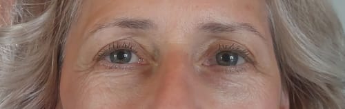 Customer photo review of Wimpernserum Plus
