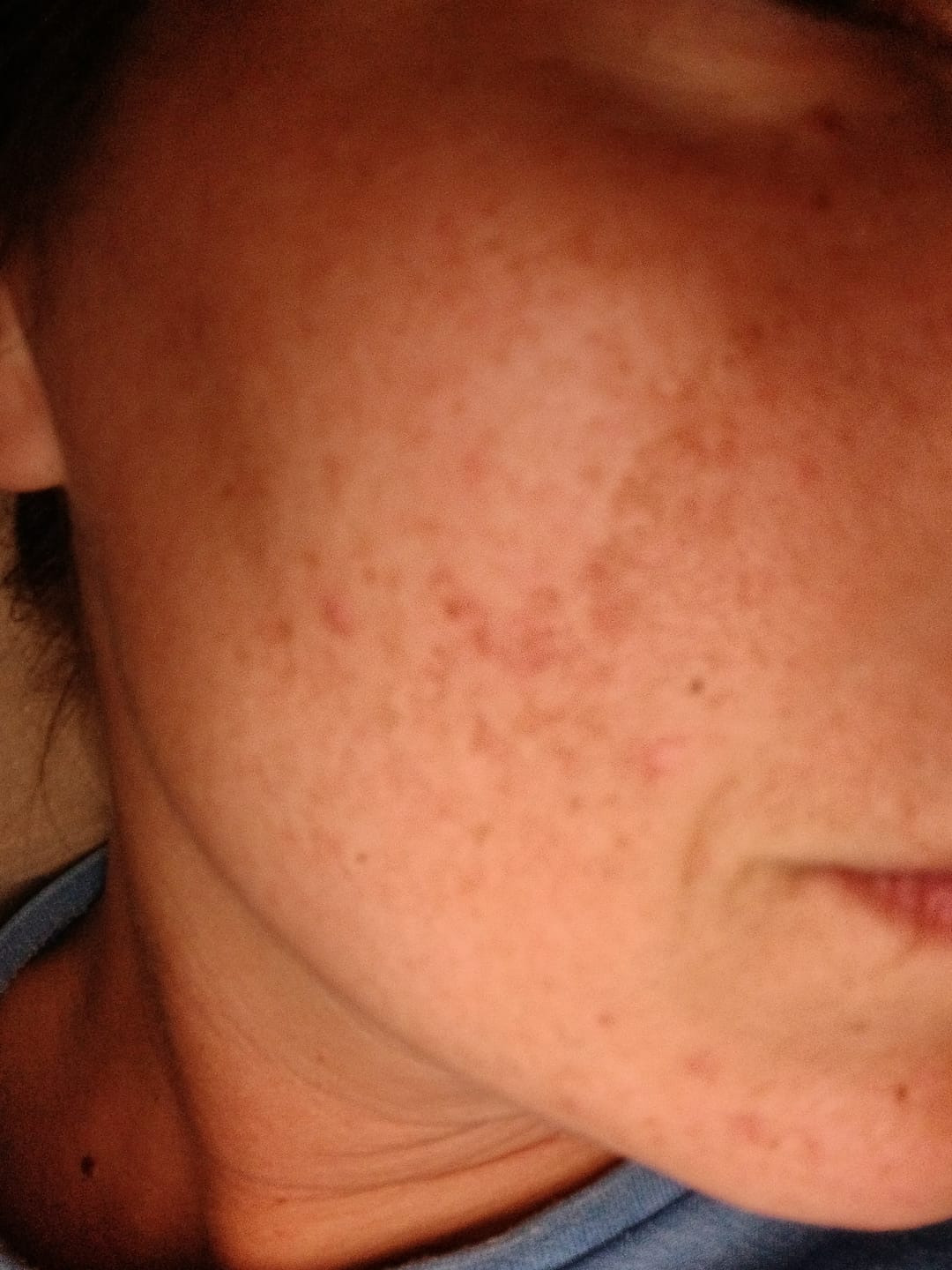 Customer photo review of Oercrème Tallow Vitamine E