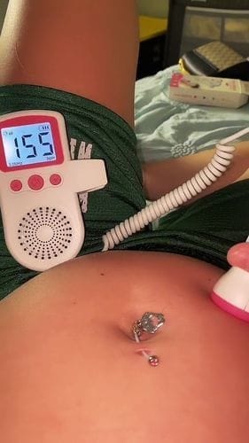 Customer photo review of Sonoline B Baby Doppler