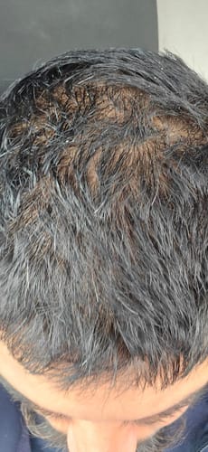 Customer photo review of Seb Natural Calming Serum