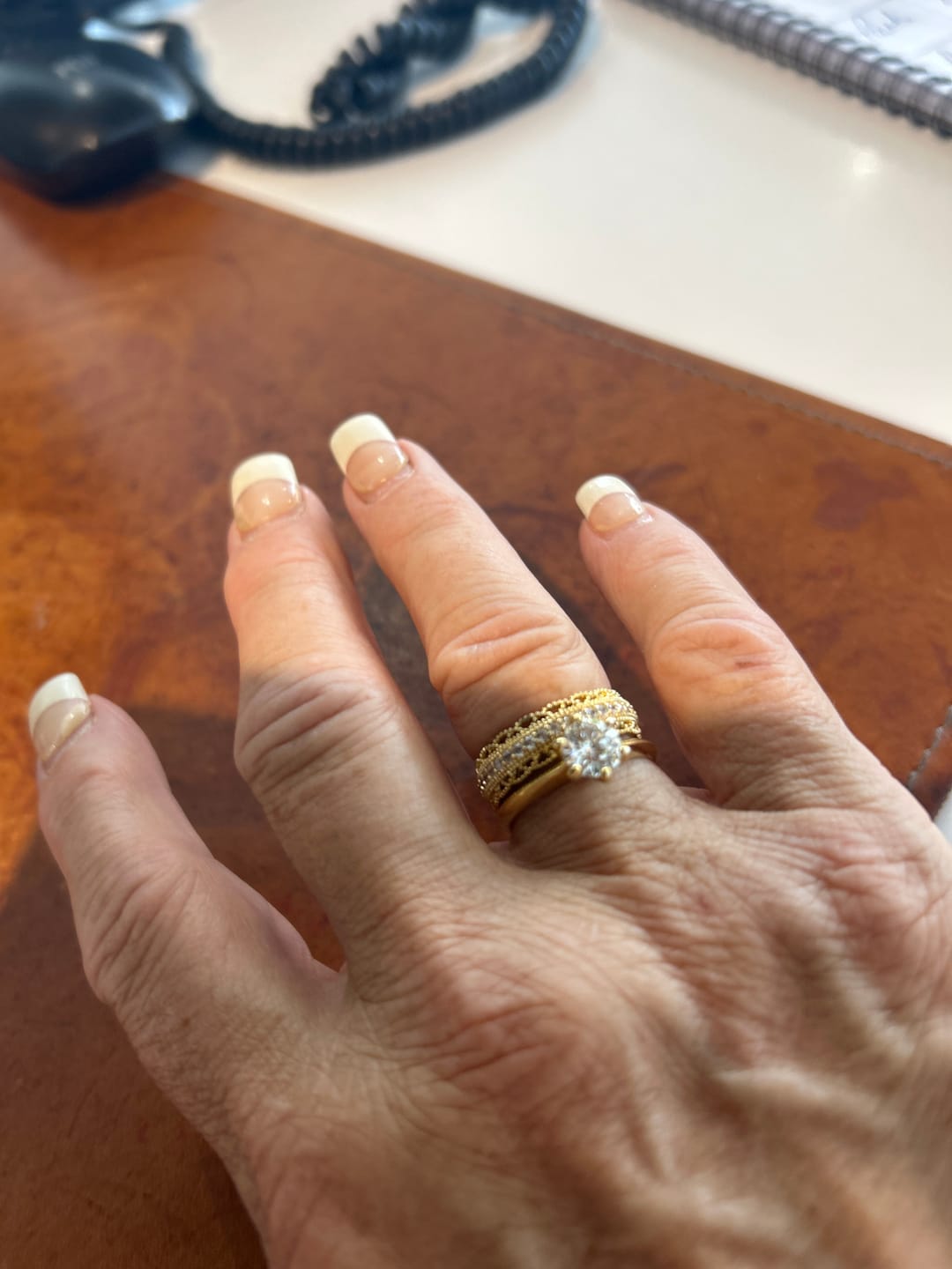 Customer photo review of Eterna Ring
