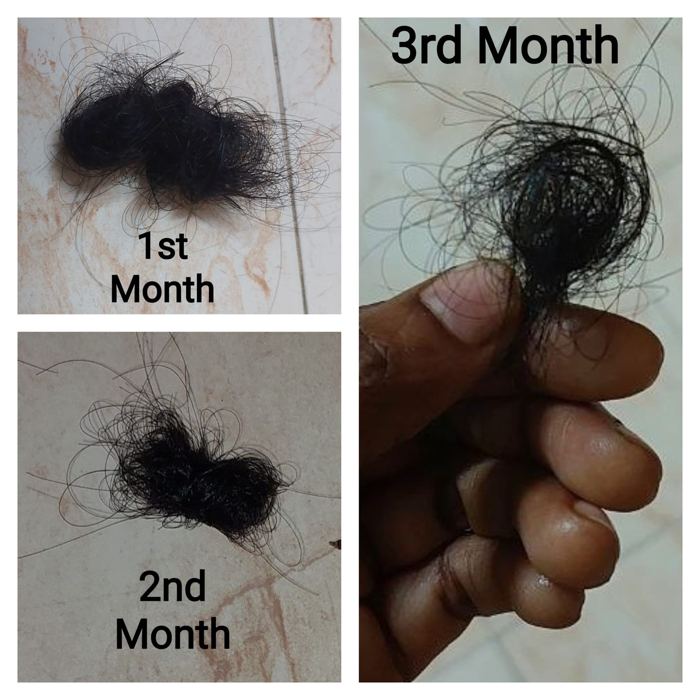 Customer photo review of Advance Hair Growth Serum 2.0 (30ml)