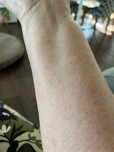 Customer photo review of Body Serum