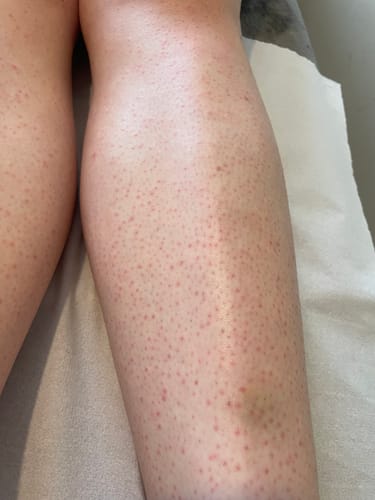 Customer photo review of Hibiscus Soft Wax 414 ml