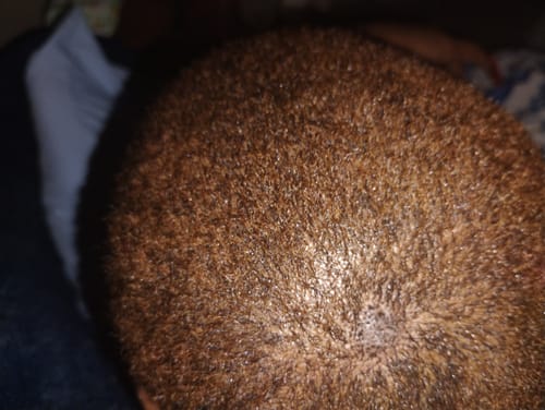 Customer photo review of VIRAL "EXTREME STRENGTH" Hair Growth Serum -