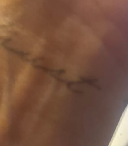 Customer photo review of Tattoo Destroyer - Tattoo Removal Cream