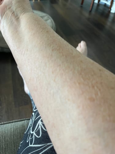 Customer photo review of Body Serum