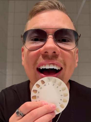 Customer photo review of Smile360 -  Brosse à dent automatique