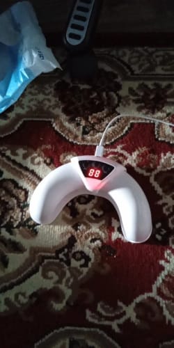 Customer photo review of NUVEX Multi-Nail LED Anti-Fungus Device