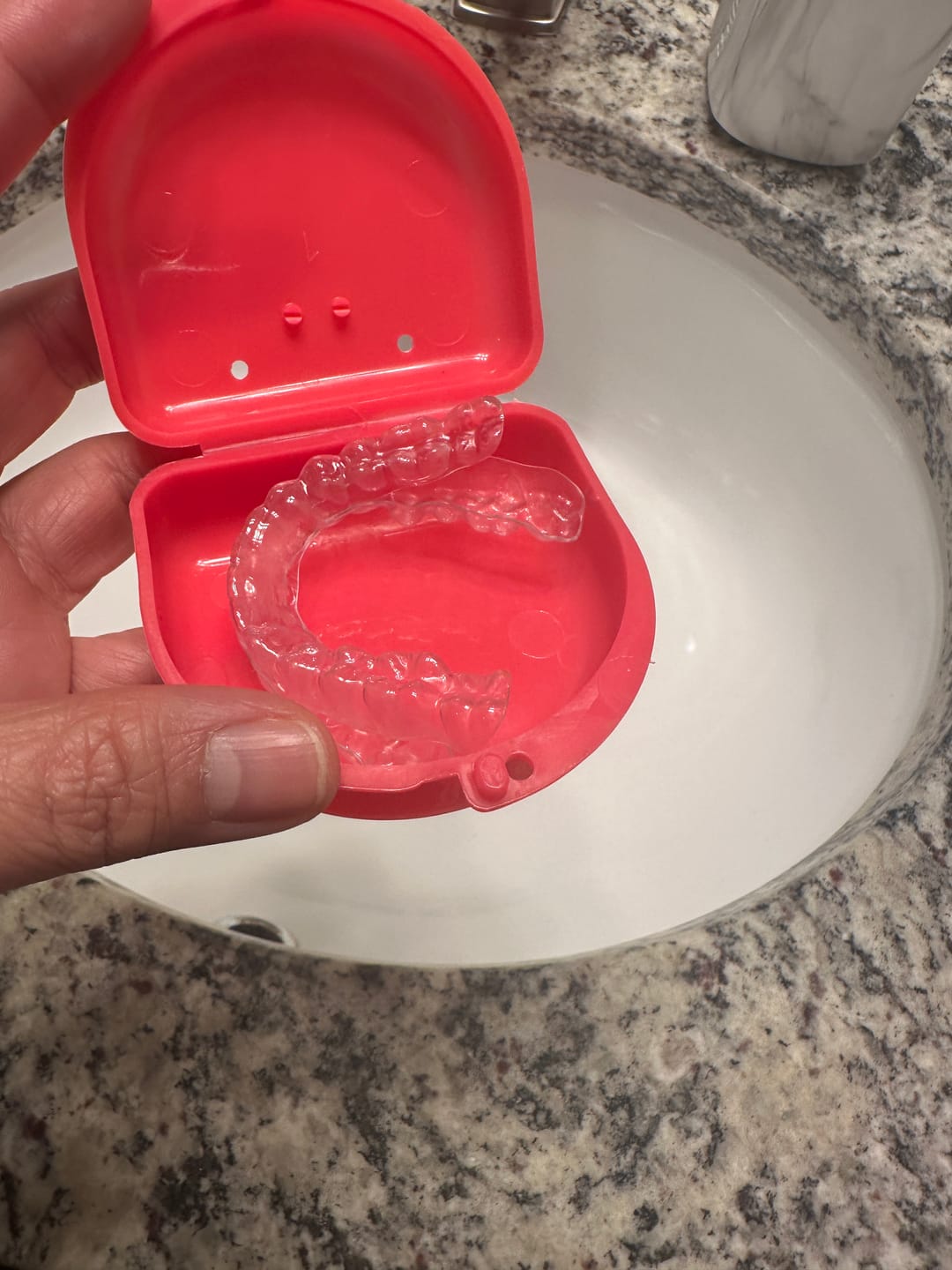 Customer photo review of REORDER-Premium Upper and Lower Retainer Set