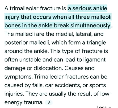 Customer photo review of Premium Bamboo Ankle Support