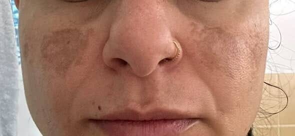 Customer photo review of ⚡ Turmeric Vitamin C Clay Mask