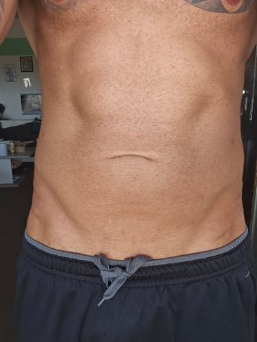 Adrian B. review of 2x Belle Body Haarentfernung image 1 out of 2