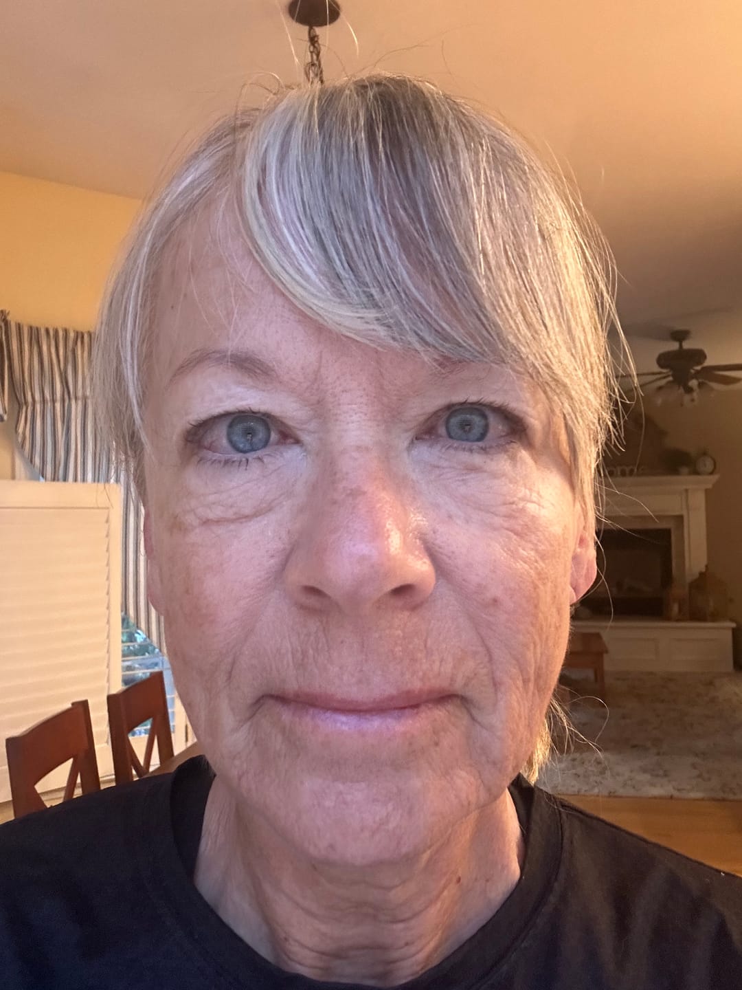 Customer photo review of The Complete System for Mature Women’s Skin