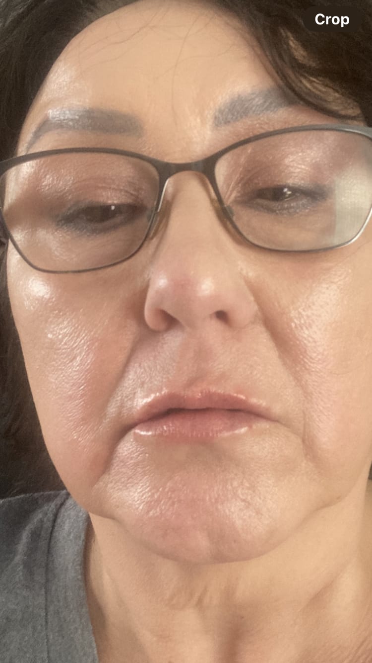Customer photo review of The Miracle Collection