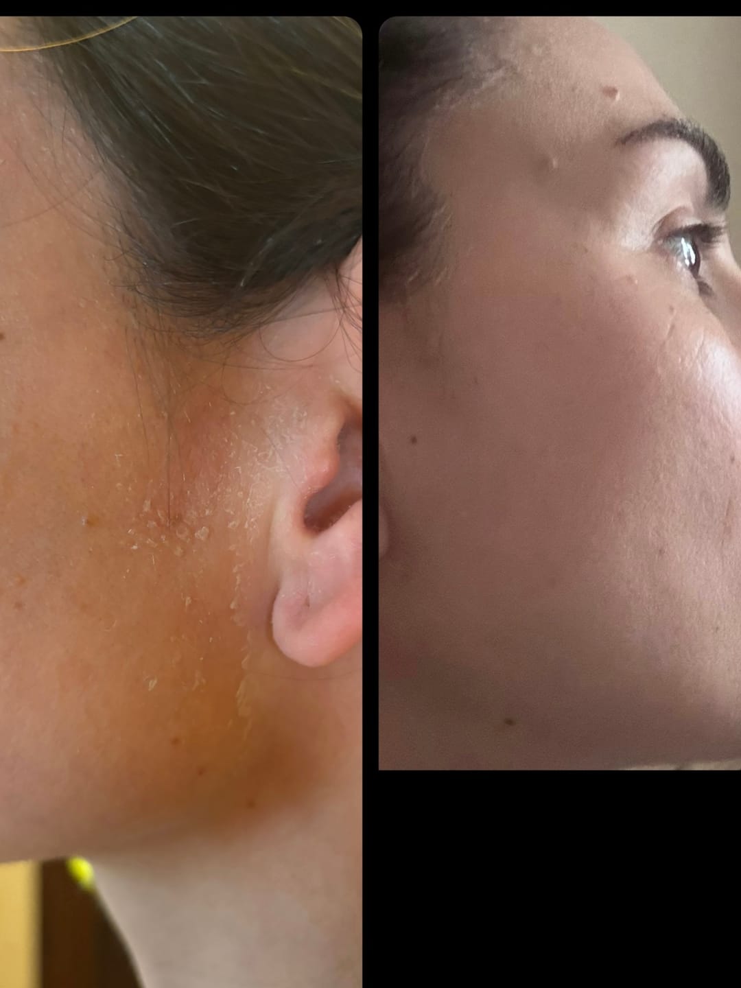 Customer photo review of HydraX+ | Бариерен крем със серамиди