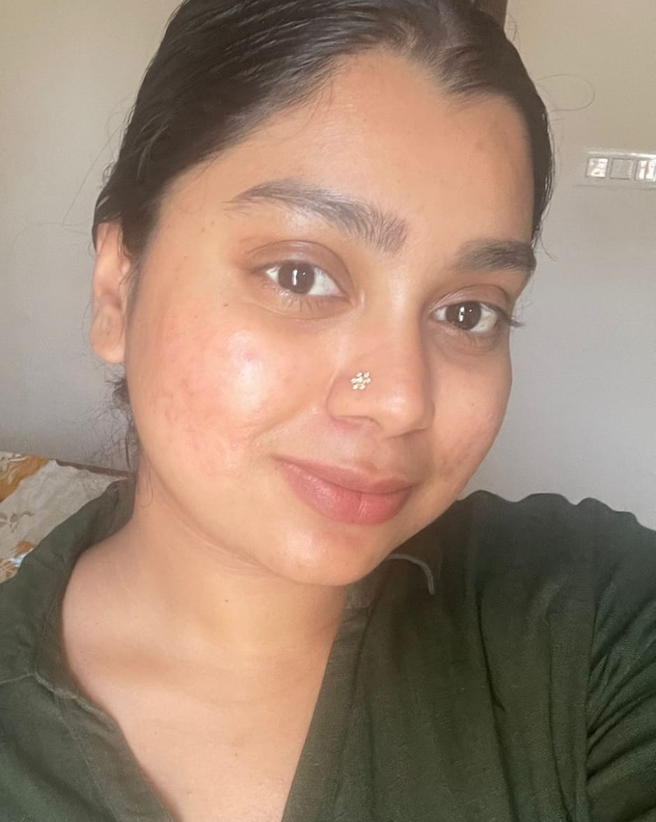 Customer photo review of Radiant Halo Screw Nose Pin