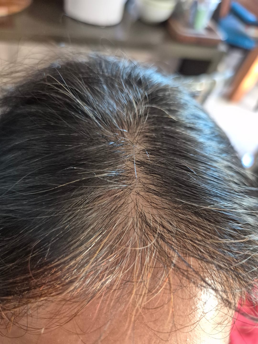 Customer photo review of 3 MESES de DÚO ANTIcaída CRECIMIENTO INTENSIVO Bomba + Tónico