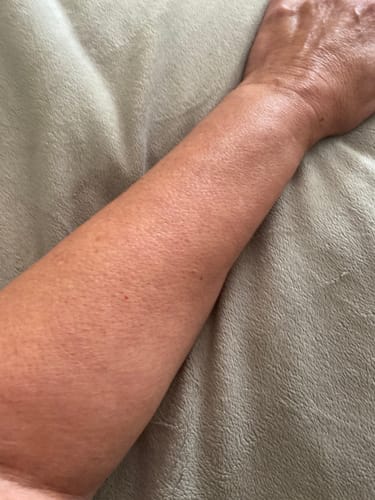 Customer photo review of Besque™ Magic Body Oil - 100ml