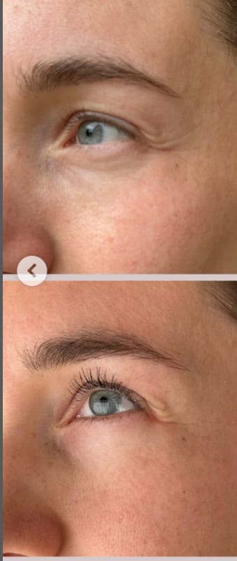 Customer photo review of Eye & Lip cream (coming june 17th)