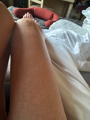 Customer photo review of Besque™ Magic Body Oil - 100ml