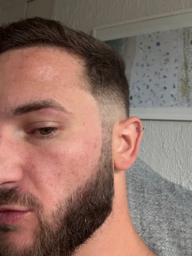 Customer photo review of Neptune Grass Fed Tallow Sunscreen