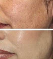 Customer photo review of OUTGLOW - Radiance Tri-Factor™ Jelly
