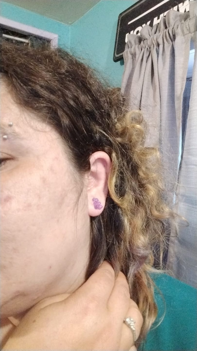Customer photo review of Gummy Bear Studs Hypoallergenic Earrings for Sensitive Ears Made with Plastic Posts