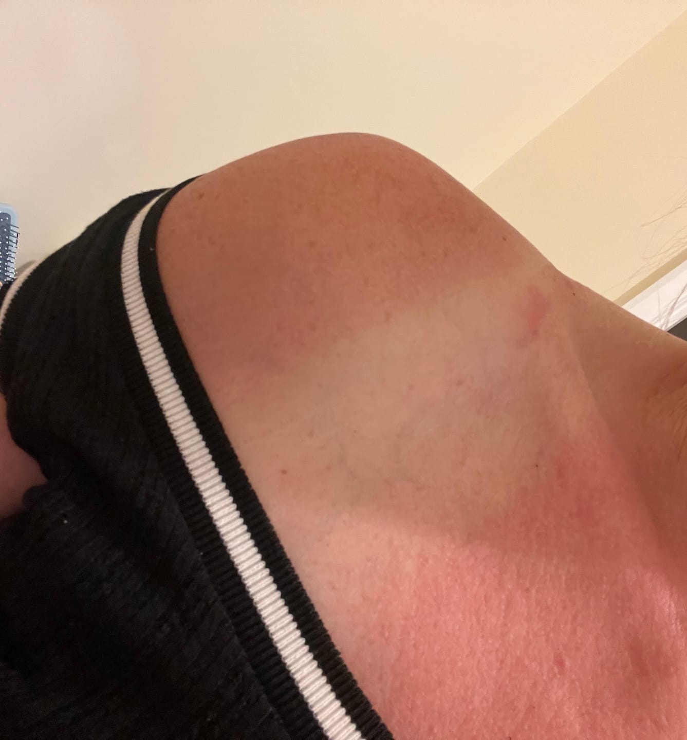 Customer photo review of Melanoboost Peptide Sun Tanning Lotion