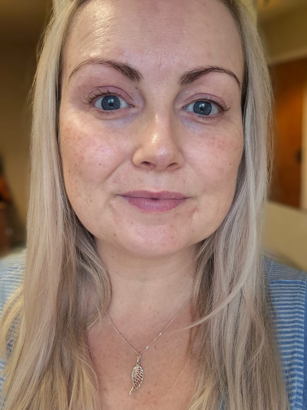Customer photo review of Cleanser · Purifying Salicylic  - 100ml