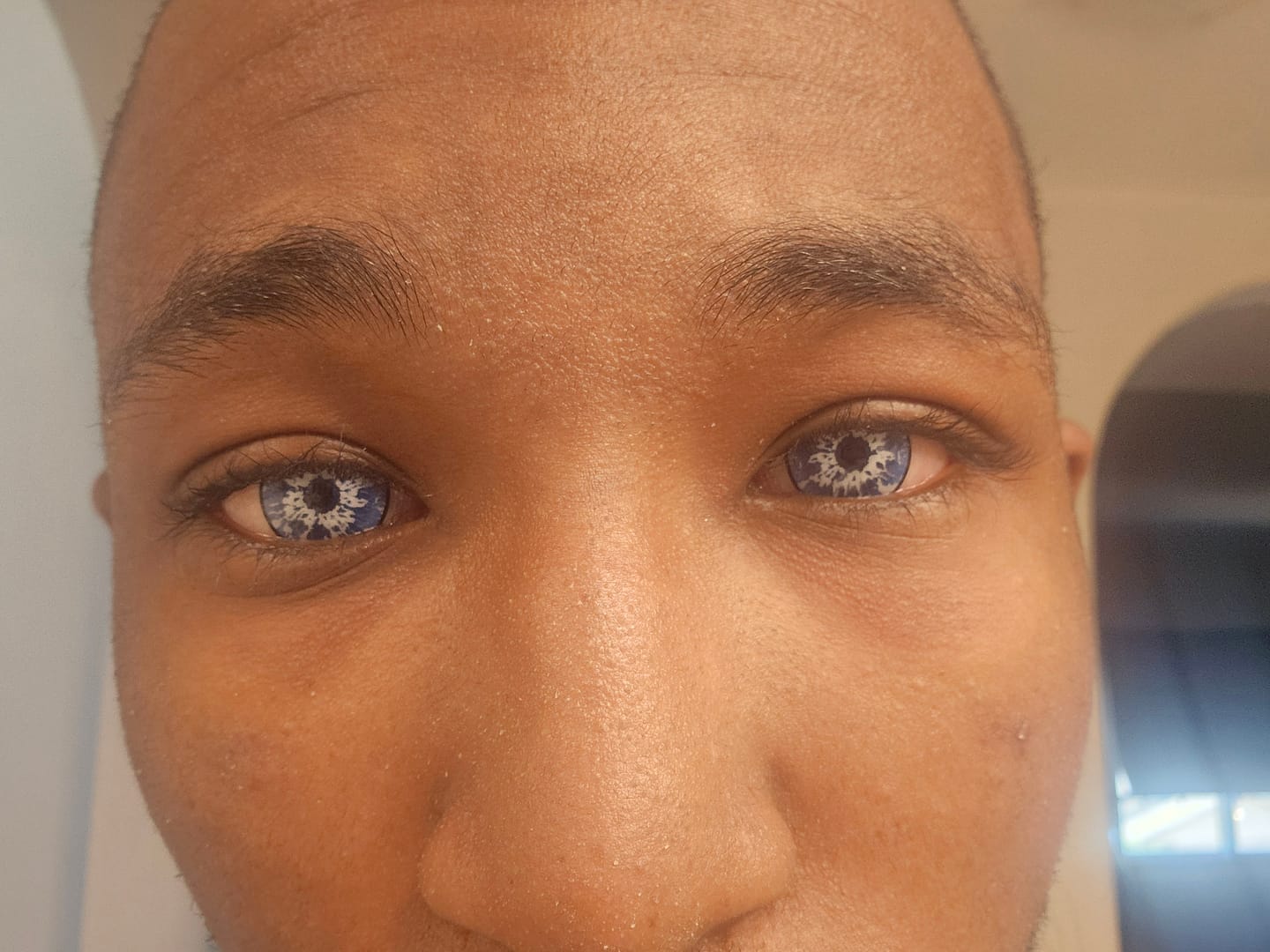Customer photo review of Cosplay Gojo Blue Colored Contact Lenses