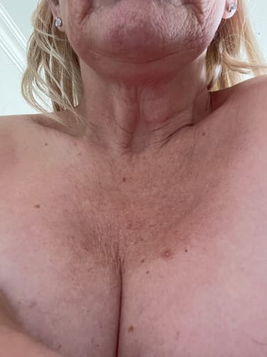 Customer photo review of Besque™ Magic Body Oil - 100ml