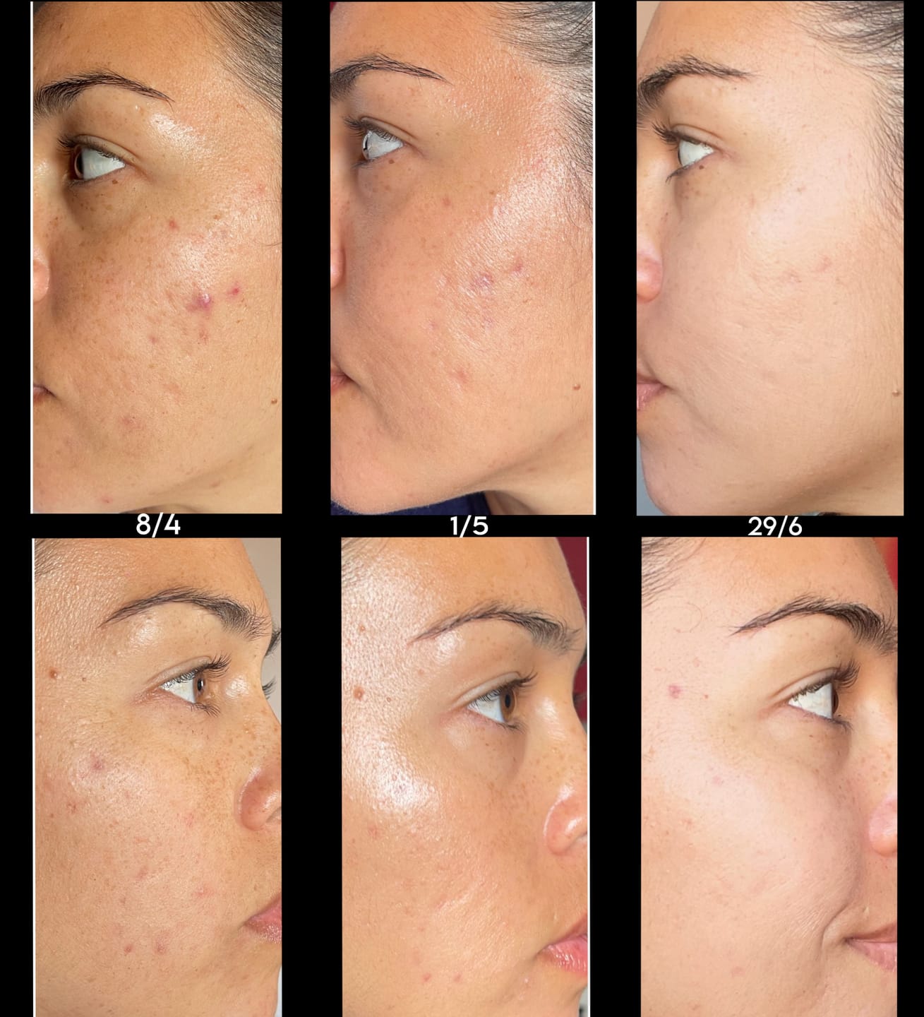 Customer photo review of RUTINA AM&PM - GRANITOS + MARCAS + POROS + MANCHAS + ARRUGAS