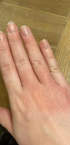 Customer photo review of AquaLab® Shower Filter