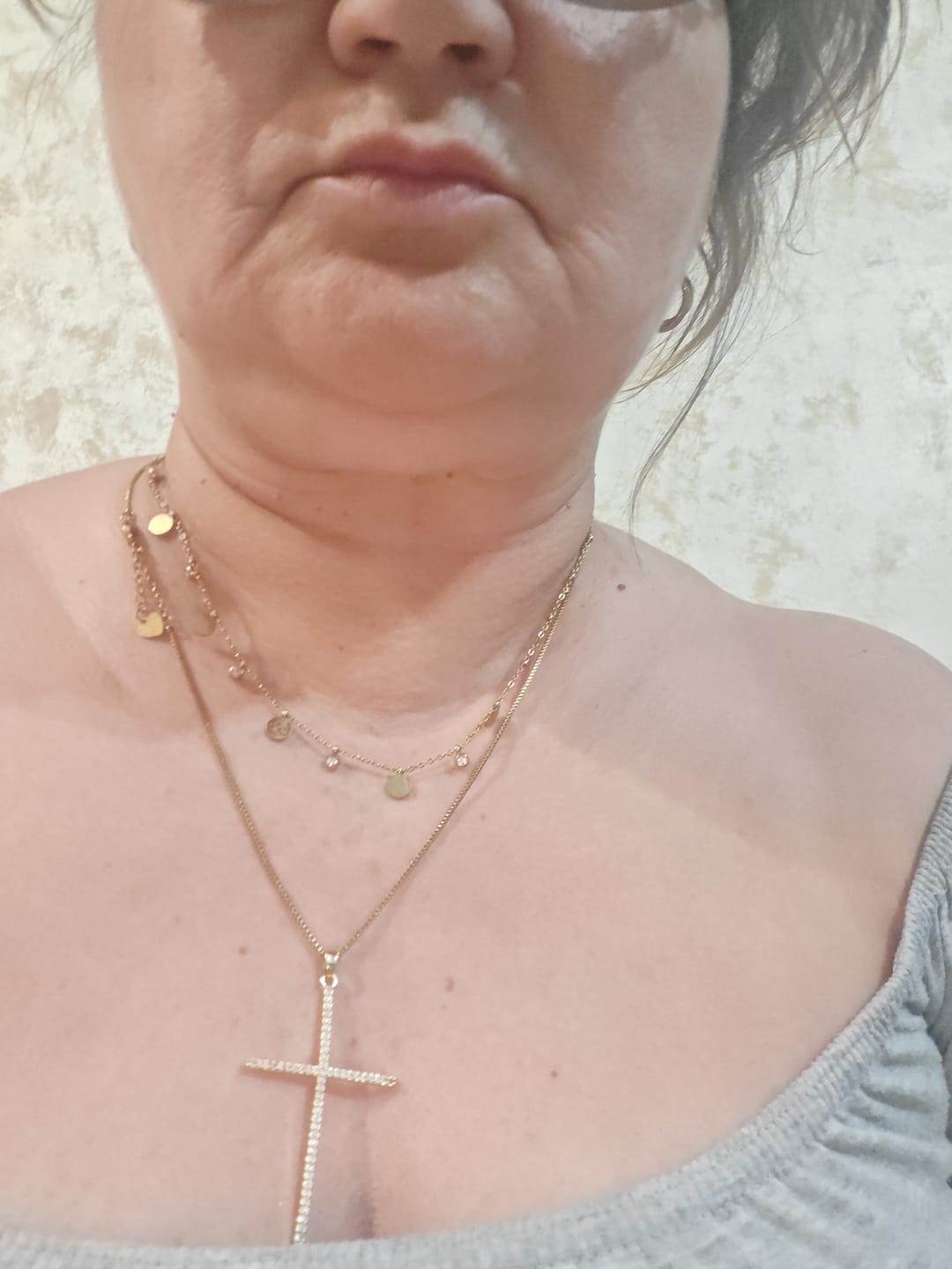 Customer photo review of Lantisor Golden Drops