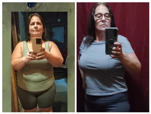 Customer photo review of Tirzepatide Weight Loss Program