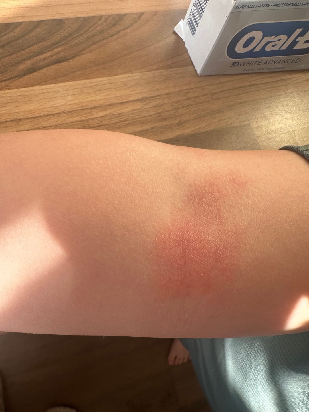 Customer photo review of Bioskin Junior Duo Pack