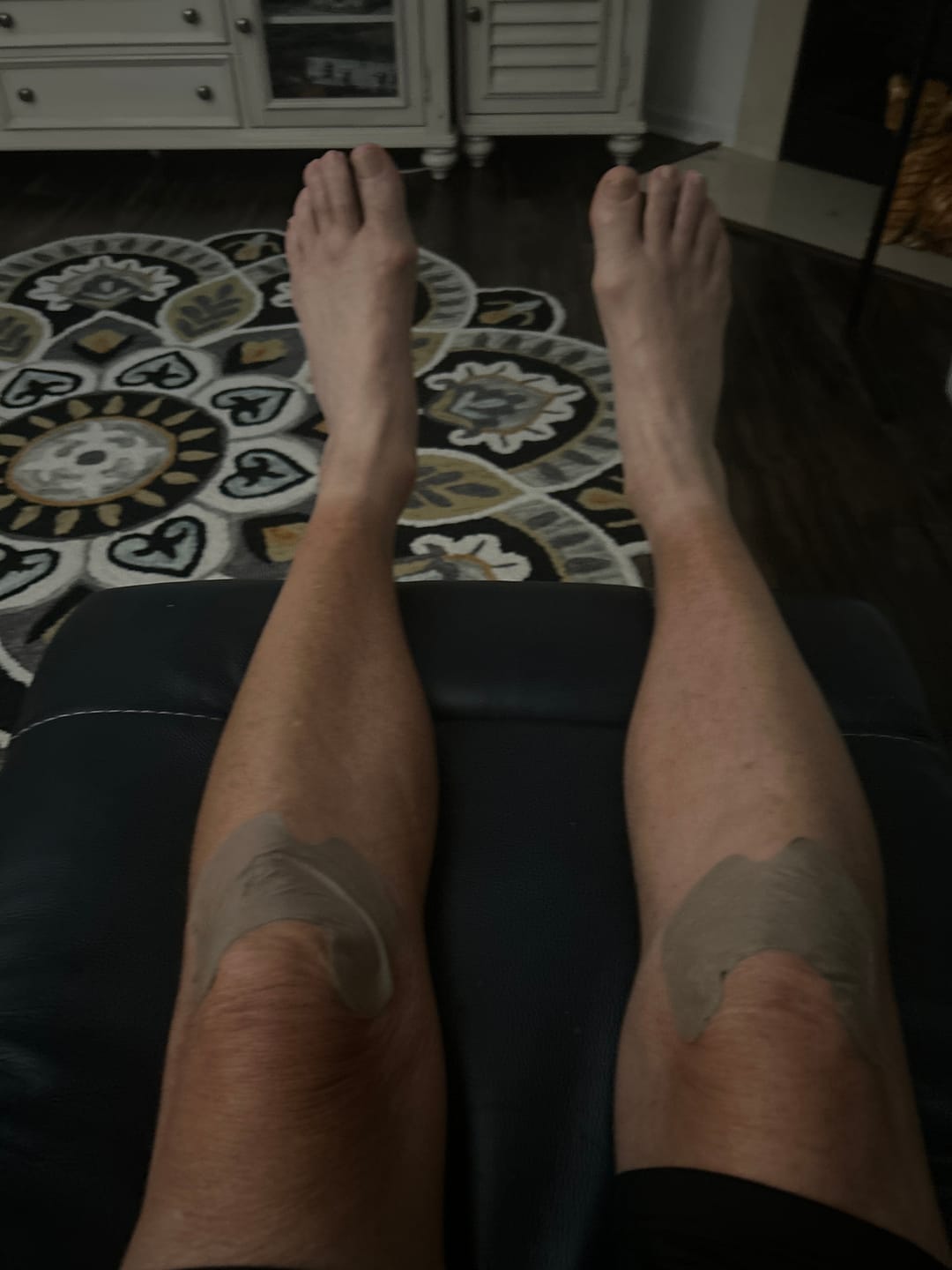 Customer photo review of Auxilium Joint Patches (fka "Heaven Patch")