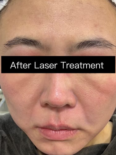 undefined review of mesoestetic crystal fiber mask (25mL x 5) image 1 out of 5