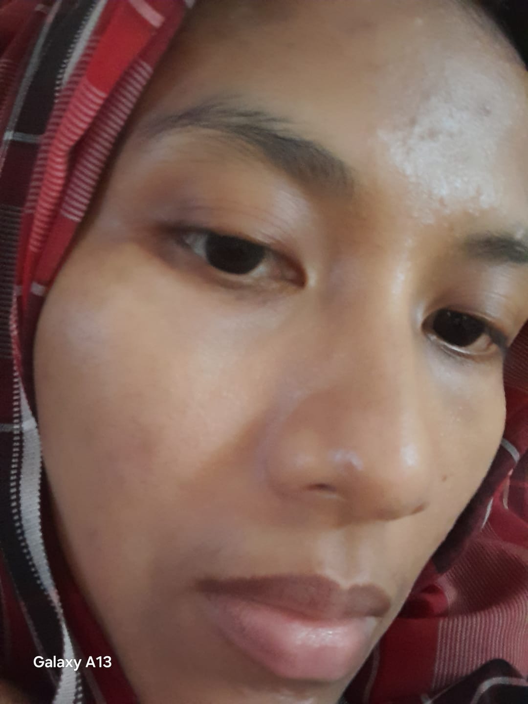 Customer photo review of Water Gel UV Sunscreen